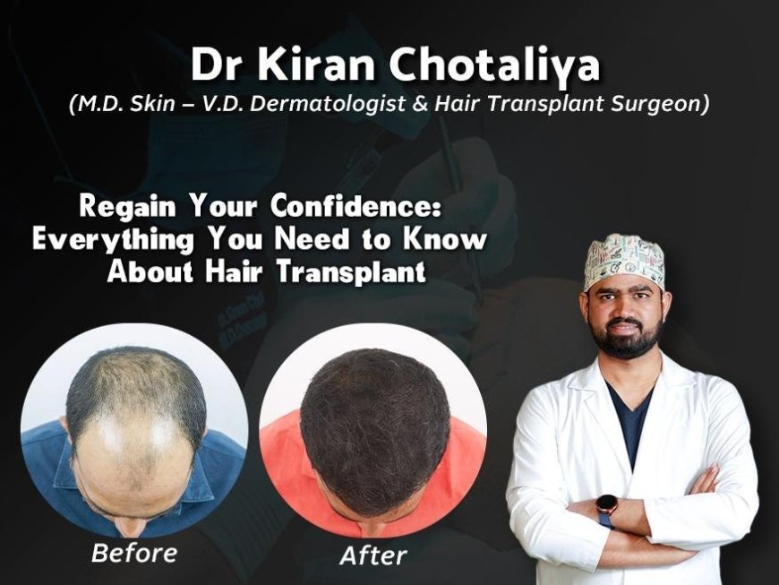 Best Hair Transplant in Pune: Dr. Kiran Chotaliya’s Expertise in latest Hair Transplant Technique